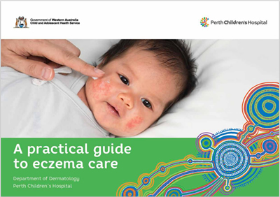 A Practical Guide to Eczema Care