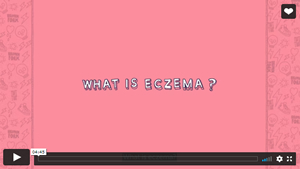 NAS what is eczema teen